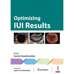 Optimizing IUI Results book by Sunita Tandulwadkar