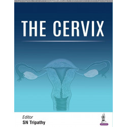 The Cervix (POD) book by M.D. Tripathy, S. N.