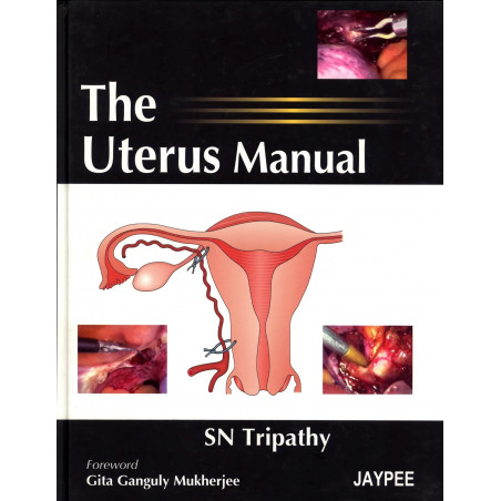 THE UTERUS MANUAL book by Tripathy