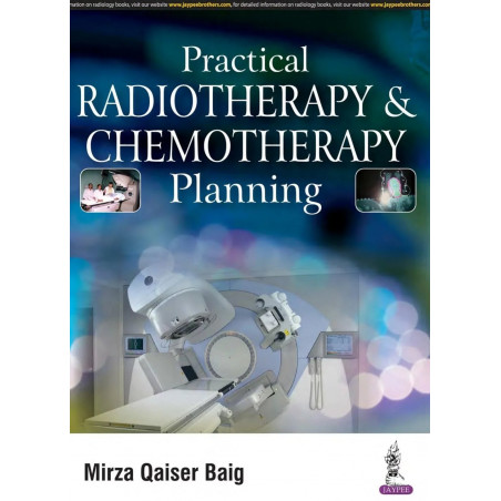 PRACTICAL RADIOTHERAPY & CHEMOTHERAPY PLANNING book by Mirza Qaiser Baig