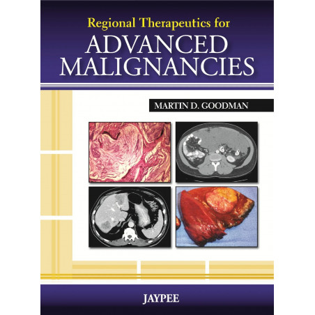 Regional Therapeutics for Advanced Malignancies book by Goodman
