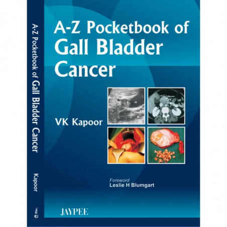 A-Z POCKET BOOK OF GALL BLADDER CANCER book by Kapoor