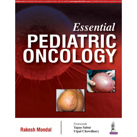 ESSENTIAL PEDIATRIC ONCOLOGY book by Mondal Rakesh