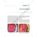 A PRACTICAL APPROACH TO CERVICAL CANCER SCREENING TECHNIQUES book by Prabhu T Radha Bai - Additional Image 6