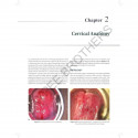 A PRACTICAL APPROACH TO CERVICAL CANCER SCREENING TECHNIQUES book by Prabhu T Radha Bai - Additional Image 7