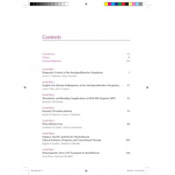 CONTEMPORARY MANAGEMENT OF MYELOPROLIFERATIVE NEOPLASMS book by Stein Brady I - Additional Image 6