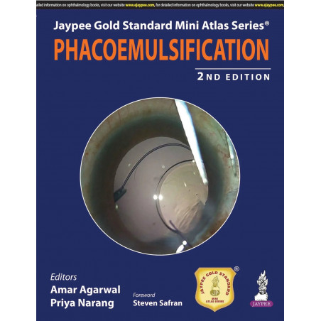 JAYPEE GOLD STANDARD MINI ATLAS SERIES PHACOEMULSIFICATION WITH DVD-ROM book by Agarwal Amar