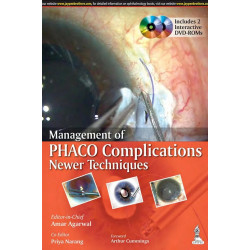 MANAGEMENT OF PHACO COMPLICATIONS NEWER TECHNIQUES INCLUDES 2 INT.DVD-ROM book by Agarwal Amar
