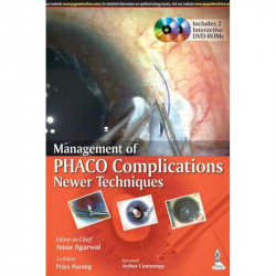 MANAGEMENT OF PHACO COMPLICATIONS NEWER TECHNIQUES INCLUDES 2 INT.DVD-ROM book by Agarwal Amar - Back Cover