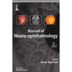 Manual of Neuro-ophthalmology book by Agarwal Amar