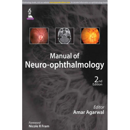 Manual of Neuro-ophthalmology book by Agarwal Amar