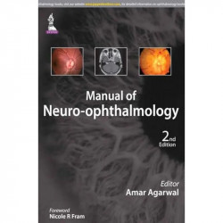 Manual of Neuro-ophthalmology book by Agarwal Amar - Back Cover