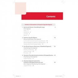 MANAGEMENT OF PHACO COMPLICATIONS NEWER TECHNIQUES INCLUDES 2 INT.DVD-ROM book by Agarwal Amar - Additional Image 6