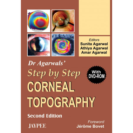 DR.AGARWALS' STEP BY STEP CORNEAL TOPOGRAPHY WITH DVD-ROM book by Agarwal