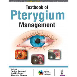 TEXTBOOK OF PTERYGIUM MANAGEMENT WITH DVD-ROM book by Tushar Agarwal, Shikha Gupta