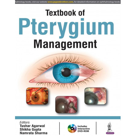 TEXTBOOK OF PTERYGIUM MANAGEMENT WITH DVD-ROM book by Tushar Agarwal, Shikha Gupta