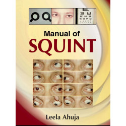 Manual of Squint book by Ahuja Leela