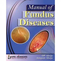 Manual of Fundus Diseases book by Ahuja Op
