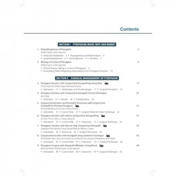 TEXTBOOK OF PTERYGIUM MANAGEMENT WITH DVD-ROM book by Tushar Agarwal, Shikha Gupta - Additional Image 6