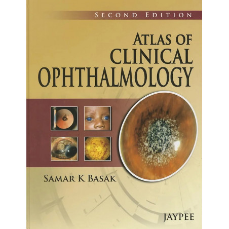 Atlas of Clinical Ophthalmology book by Basak