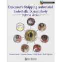 Descemet'S Stripping Automated Endothelial Keratoplasty:Different Strokes book by Sharma Cassidy