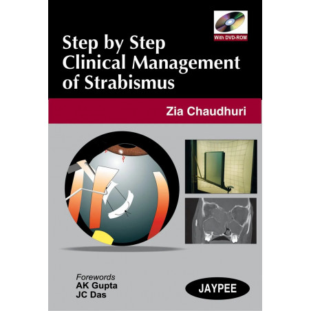 STEP BY STEP CLINICAL MANAGEMENT OF STRABISMUS WITH DVD-ROM book by Zia Chaudhuri