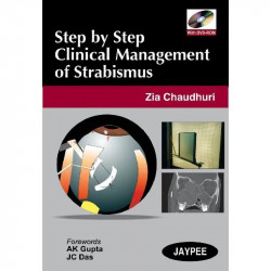 STEP BY STEP CLINICAL MANAGEMENT OF STRABISMUS WITH DVD-ROM book by Zia Chaudhuri - Back Cover