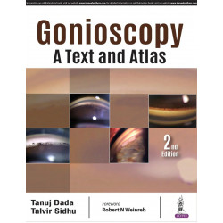 Gonioscopy: A Text and Atlas book by Tanuj Dada, Sidhu