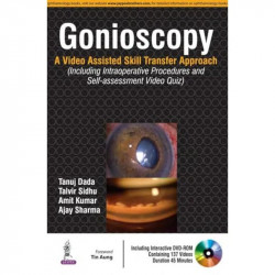 GONIOSCOPY:A VIDEO ASSISTED SKILL TRANSFER APPROACH WITH DVD-ROM book by Dada Tanuj - Back Cover