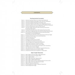 GONIOSCOPY:A VIDEO ASSISTED SKILL TRANSFER APPROACH WITH DVD-ROM book by Dada Tanuj - Additional Image 6