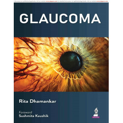 Glaucoma: A Ready Reckoner for Ophthalmologists and Postgraduate Students | Comprehensive Diagnosis, Investigations, Medical…
