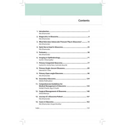 Glaucoma: A Ready Reckoner for Ophthalmologists and Postgraduate Students | Comprehensive Diagnosis, Investigations, Medical… -