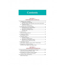 Instant Clinical Diagnosis in Ophthalmology: Lens Diseases (POD) book by Garg - Back Cover