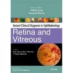 Instant Clinical Diagnosis in Ophthalmology: Retina and Vitreous book by Garg
