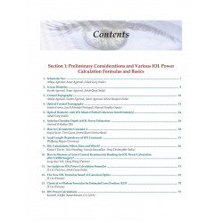 Mastering the Techniques of IOL Power Calculations book by Garg - Additional Image 3