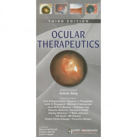 Ocular Therapeutics book by Garg Ashok