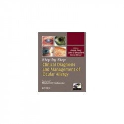 Step By Step Clinical Diagnosis And Management To Ocular Allergy With Photo Cd-rom book