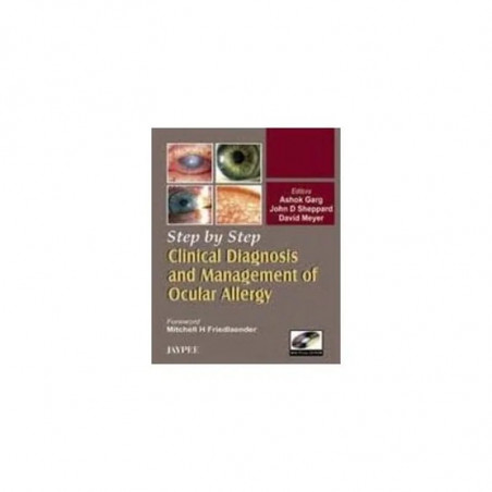 Step By Step Clinical Diagnosis And Management To Ocular Allergy With Photo Cd-rom book
