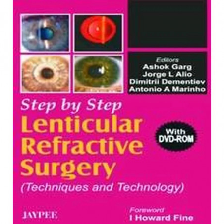 Step by Step Lenticular Refractive Surgery (with DVD ROM) book by Garg