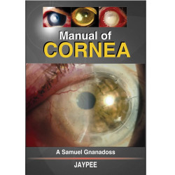 Manual Of Cornea book by Gnanadoss