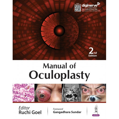 Manual of Oculoplasty book by Ruchi Goel