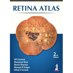 Retina Atlas book by SPS Grewal, Dilraj S Grewal Manpreet Brar, Mansi Sharma, Mangat R Dogra