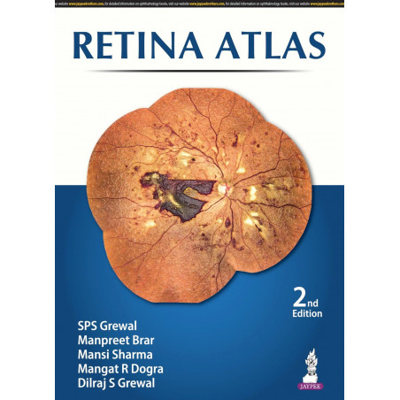 Retina Atlas book by SPS Grewal, Dilraj S Grewal Manpreet Brar, Mansi Sharma, Mangat R Dogra