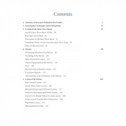 PRACTICAL APPROACH TO OPHTHALMOSCOPIC RETINAL DIAGNOSIS book by Gupta A.K. - Additional Image 3
