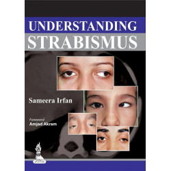 Understanding Strabismus book by Sameerasirfan