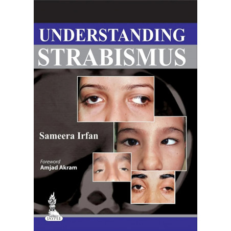 Understanding Strabismus book by Sameerasirfan