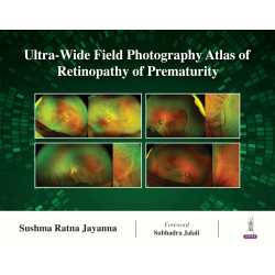 Ultra-Wide Field Photography Atlas of Retinopathy of Prematurity book by Sushma Ratna Jayanna