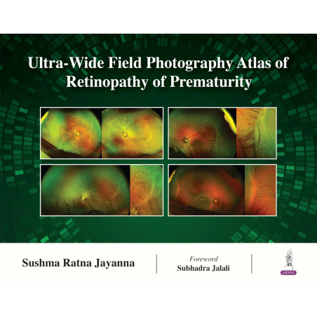 Ultra-Wide Field Photography Atlas of Retinopathy of Prematurity book by Sushma Ratna Jayanna