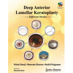 DEEP ANTERIOR LAMELLAR KERATOPLASTY DIFFERENT STROKES WITH DVD ROM book by Jhanji