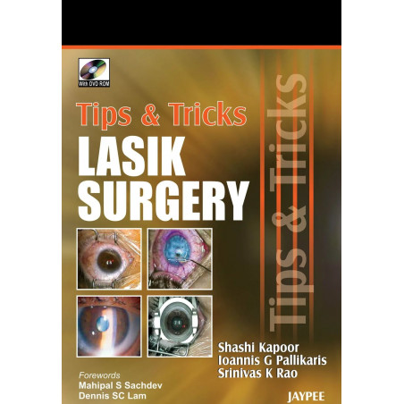 Tips & Tricks Lasik Surgery with DVD-ROM book by Shashi Kapoor